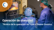 Cómo realizamos la operación de Tubo o Manga gástrica