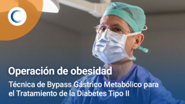 Técnica de Bypass Gástrico Metabólico para Diabetes Tipo II
