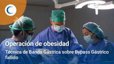 Cómo realizamos una intervención sobre un Bypass Gástrico fallido