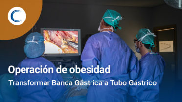 Cómo Transformar la Banda Gástrica a Tubo Gástrico