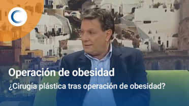 ¿Cirugía plástica tras obesidad?. Popular TV.