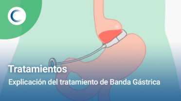 Explicación del tratamiento de banda gástrica