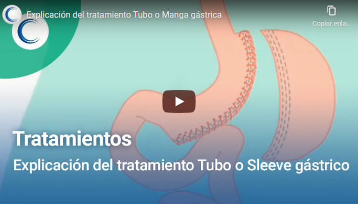 Explicacion Del Tratamiento De Tubo O Manga Gastrica Clinicas Obesitas