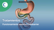 Funcionamiento sistema Endobarrier