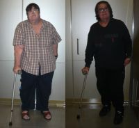 Testimonio: Toni ha perdido 65 kg en año y medio gracias a la operación de tubo gástrico