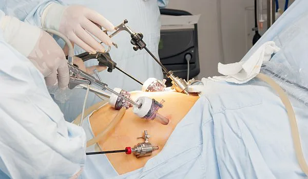 Prevenir Las Complicaciones Del Bypass Gastrico Estudio Y Preparacion Prevenir Las Complicaciones Del Bypass Gastrico Estudio Y Preparacion