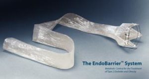 endobarrier2