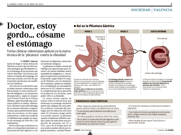 plicatura-el-mundo-clinica-obesitas