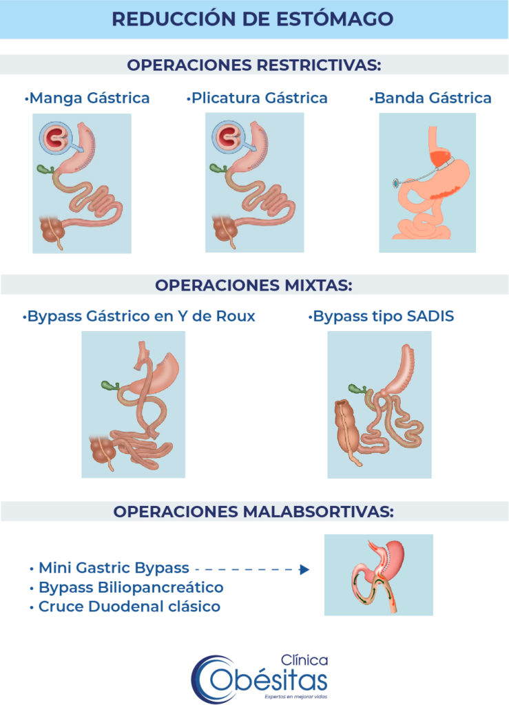 Operaciones reducción