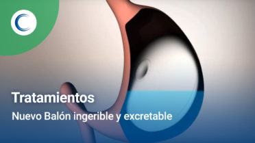 Nuevo Balón ingerible y excretable